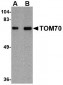 TOM70 Antibody